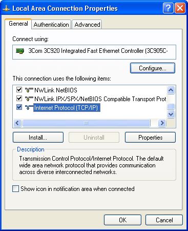 [screenshot] - Local Area Connection Properties
